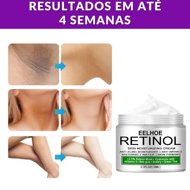 Retinol Original - Creme Clareador Facial, Virilha, Cotovelos e Axilas